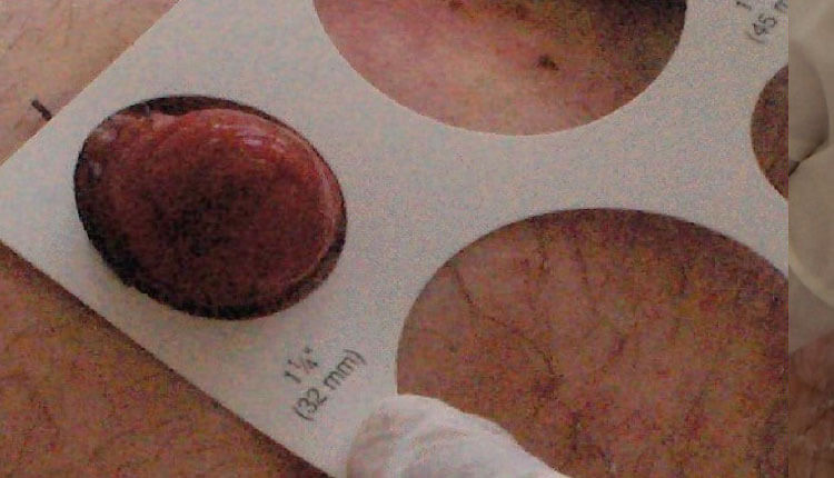 Stoma Cetveli